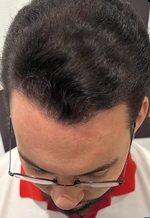 O que levar para a primeira avaliação capilar