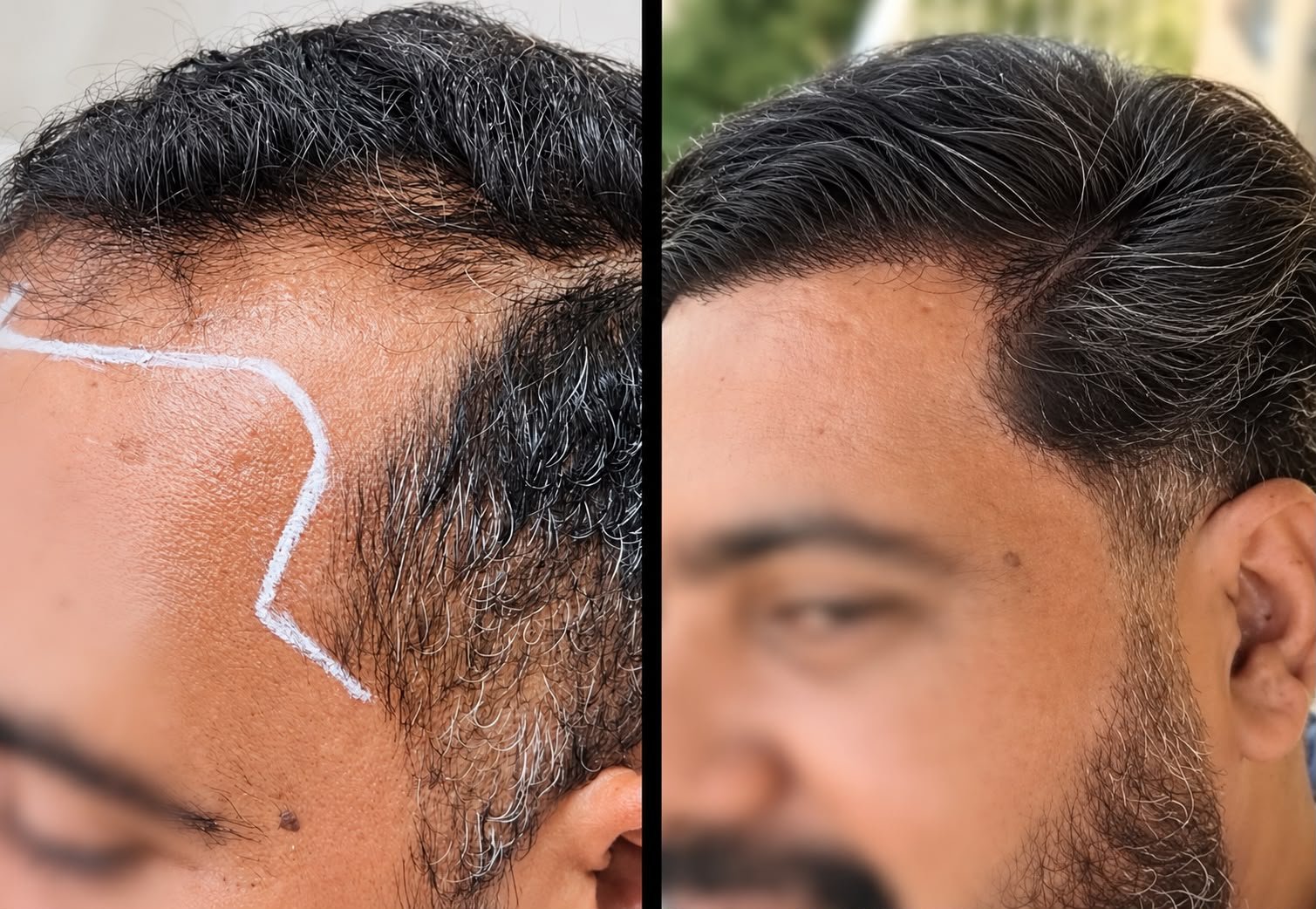 O que levar para a primeira avaliação capilar