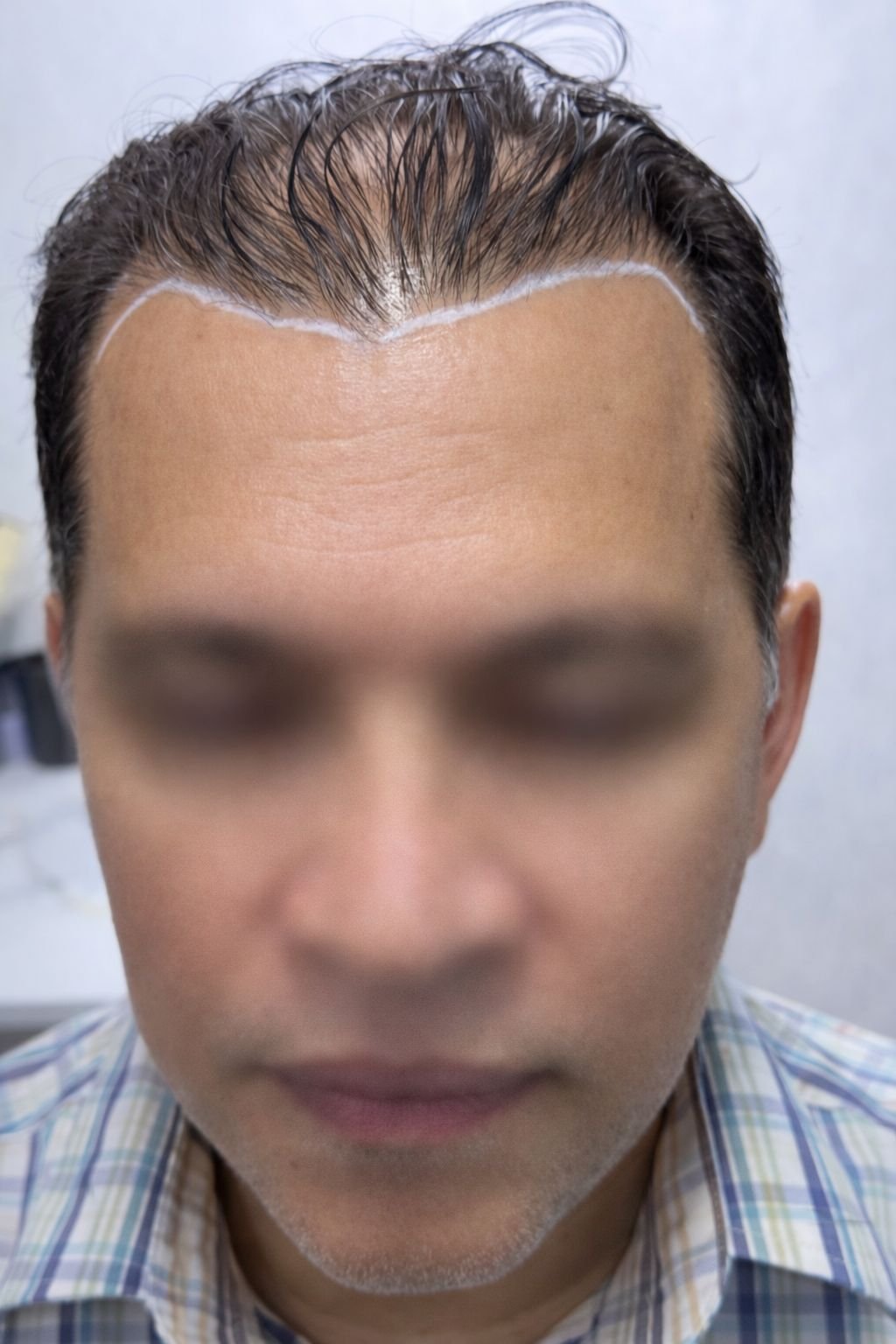 Antes — Registro 01